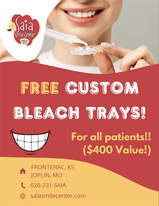 Free Custom Bleach Trays